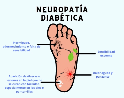 Neuropatías Diabéticas